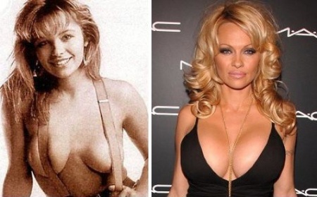 Звезды Голливуда до и после тюнинга груди
