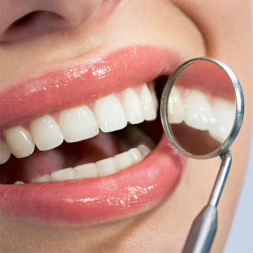 Преимущества отбеливания зубов ZOOM-3
