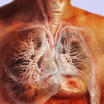 Как распознать туберкулез