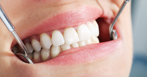 Виды несъемных зубных протезов