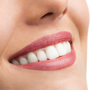 Можно ли отбелить зубы без вреда для здоровья? Обзор современных методов