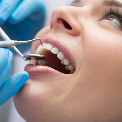 Когда нужно идти к стоматологу и как выбрать хорошую клинику