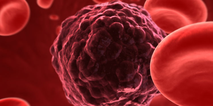 Ученые: главная причина рака - это...