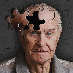 Как уберечь мозг от болезни Альцгеймера