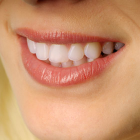 Установка виниров - отличный метод для восстановления зубов