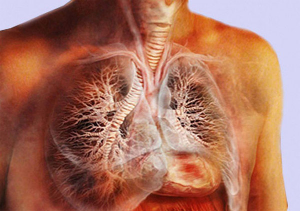 Как распознать туберкулез