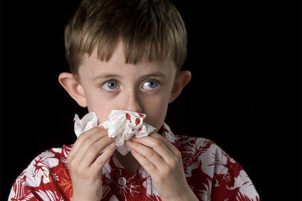У ребенка идет кровь из носа: причины