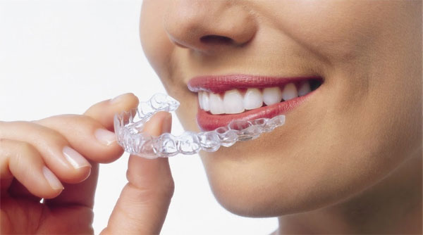 Каппы Invisalign