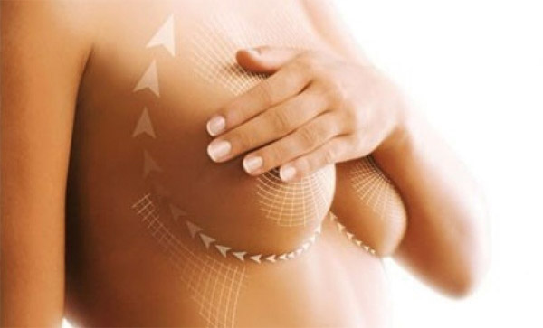 Подтяжка и увеличение груди: общие вопросы